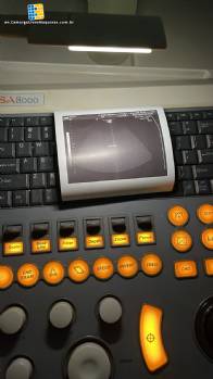 Ultrasound device for medical clinics Medison Sansung